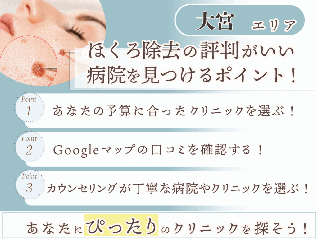 大宮(埼玉)エリアでほくろ除去の評判がいい病院を見つけるポイント