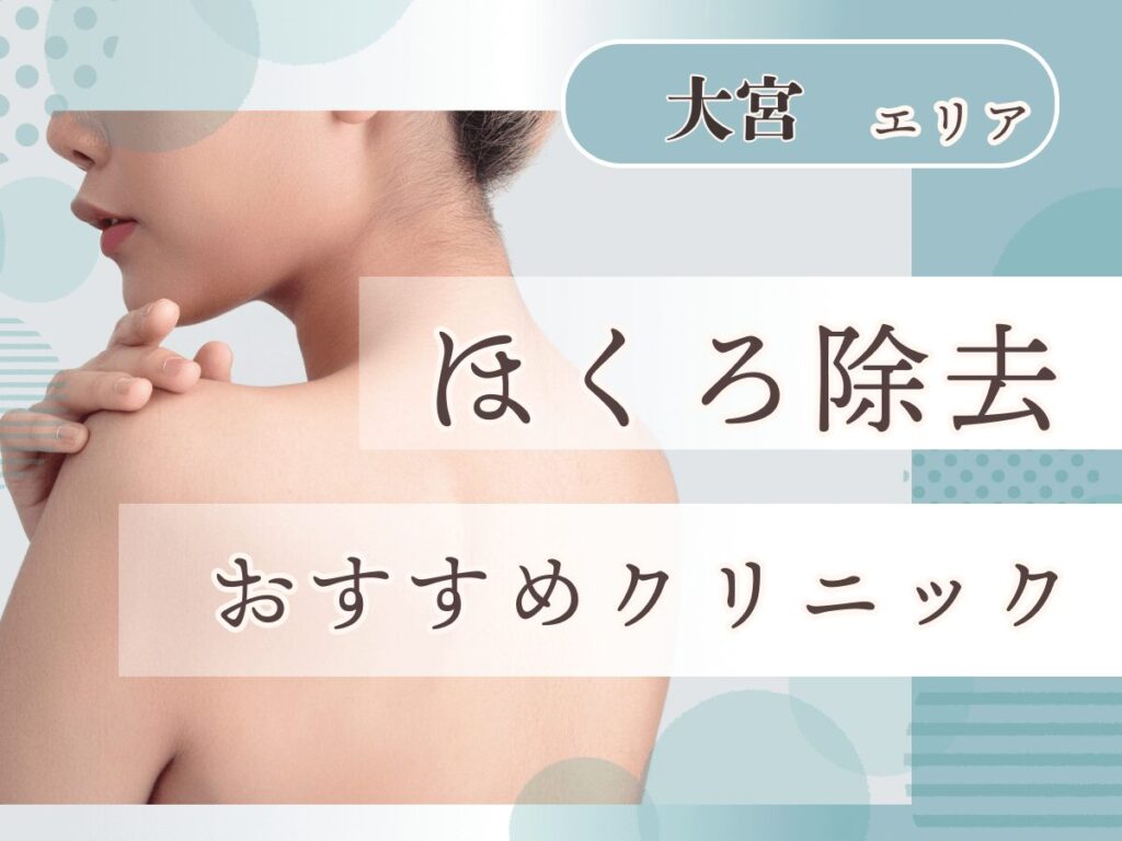 大宮(埼玉)エリアほくろ除去が安いおすすめクリニック