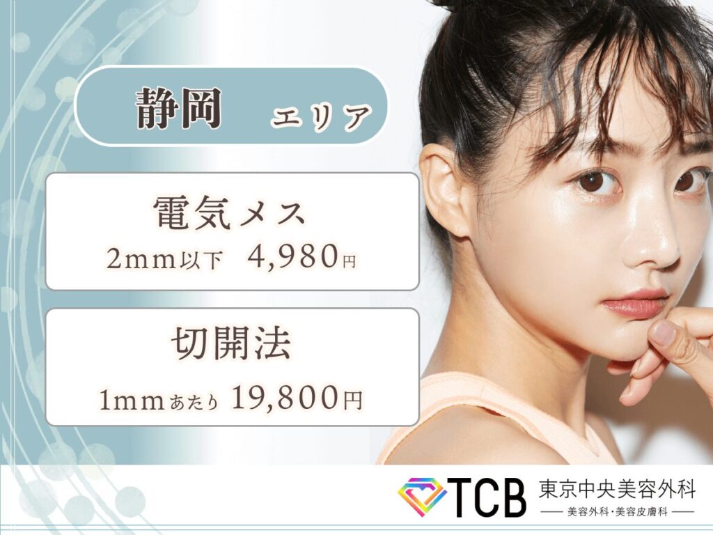 静岡エリアほくろ除去が安いおすすめクリニック:TCB東京中央美容外科