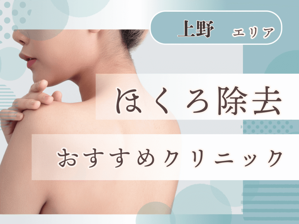 上野エリアほくろ除去が安いおすすめクリニック
