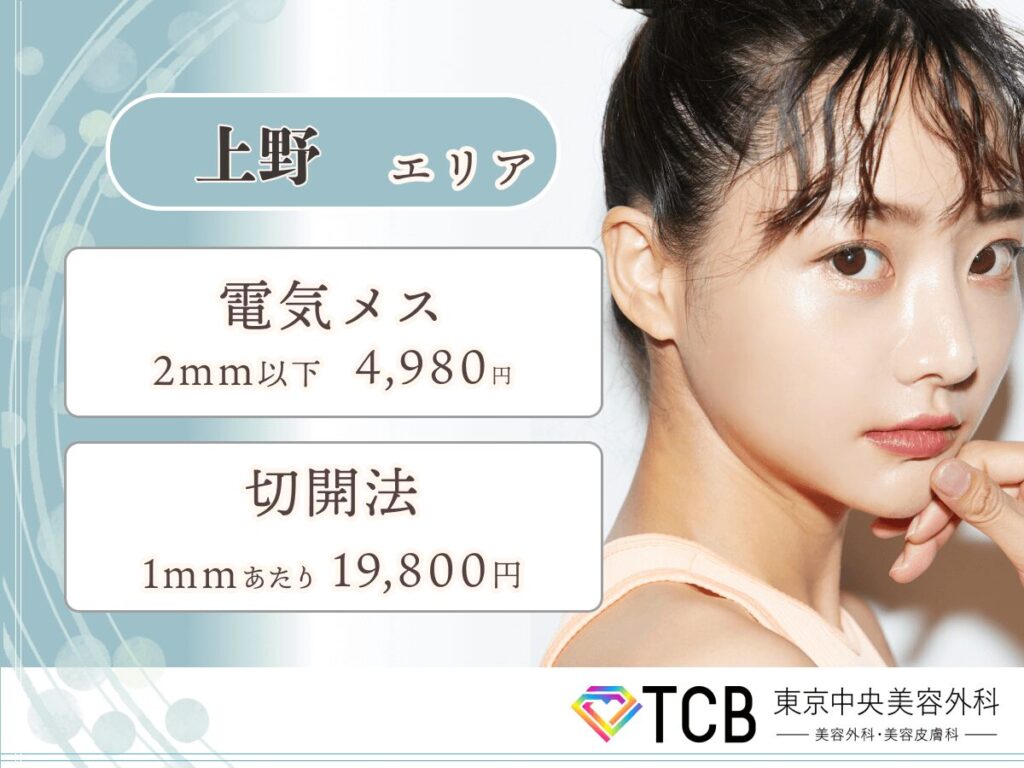 上野エリアほくろ除去が安いおすすめクリニック:TCB東京中央美容外科